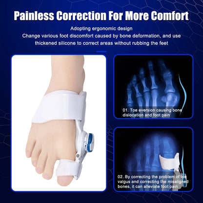 Orthopedic Bunion & Toe Corrector Success